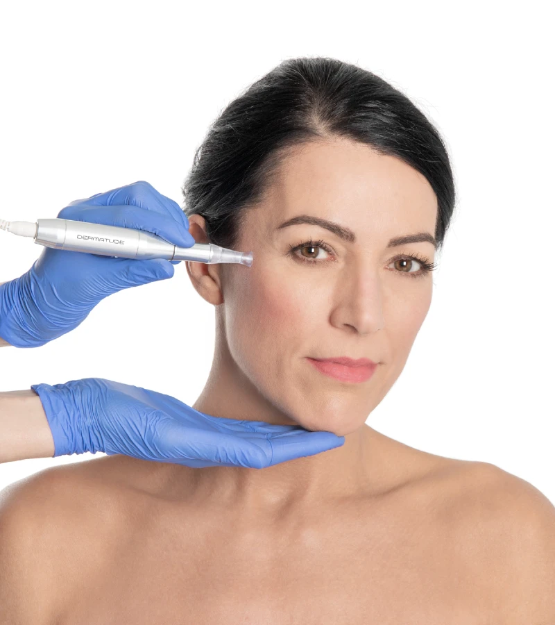 Dermatude mikrokanavointihoito